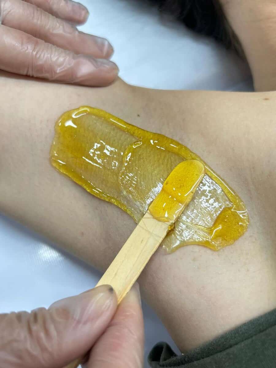 Close-up de cera morna sendo aplicada na pele durante procedimento de depilação de axilas profissional.