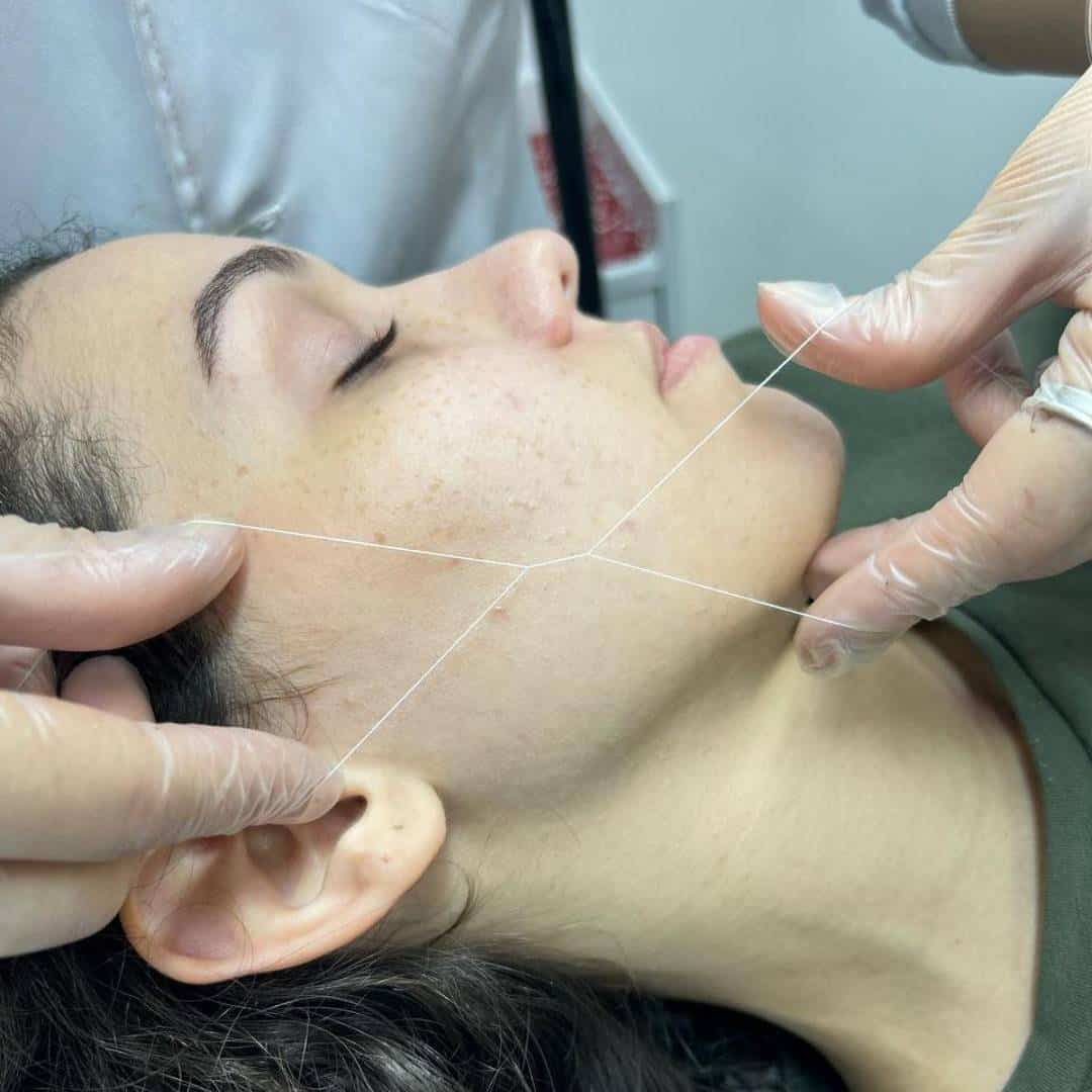Close-up da epilação com linha (threading), um dos métodos de epilação facial oferecidos no Ateliê SF Beauty.